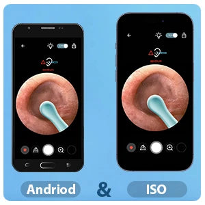 Smart Visual Ear Cleaner Set with Camera 1296P Ear Sticks Ear Wax Removal Tool HD LED Lights Earpick Endoscope Health Care