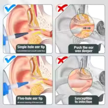 Ear Wax Removal Tool Manual Ear Irrigation Flushing Kit Ear Cleaner