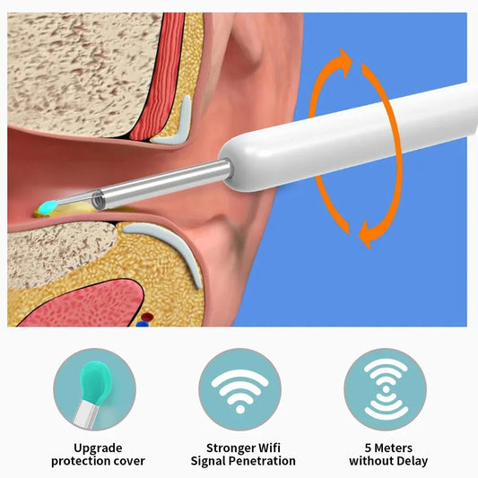 6 LED Lights Earpick Smart Visual Ear Cleaner with Camera 1296P Ear Sticks USB C Charging Ear Wax Removal Tool WIFI Connection