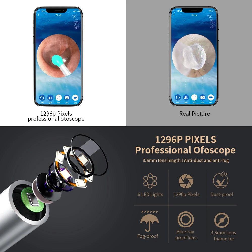 NATFIRE NE3 Ear Cleaning Kit Smart Visual Ear Sticks 1296P Ear Wax Removal Tool Wireless Ear Cleaner with Camera LED Light